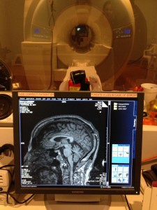 Lending my brain to a scientific study at UCSF.